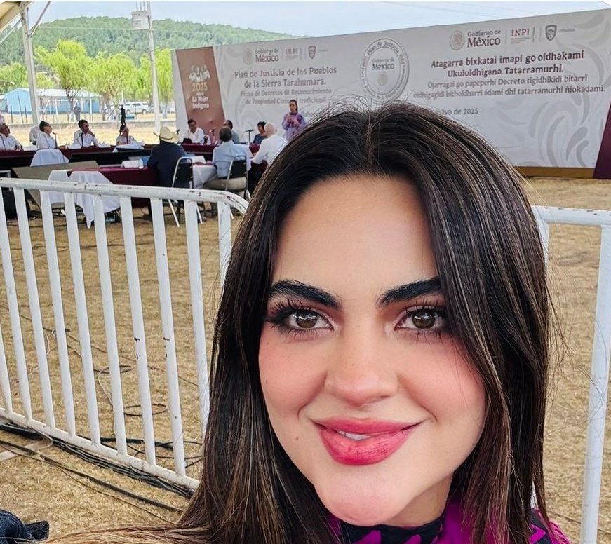 Inteligente001's tweet photo. Culpan al botox, yo creo que son sus hábitos. https://t.co/0S6p4NPXqu
