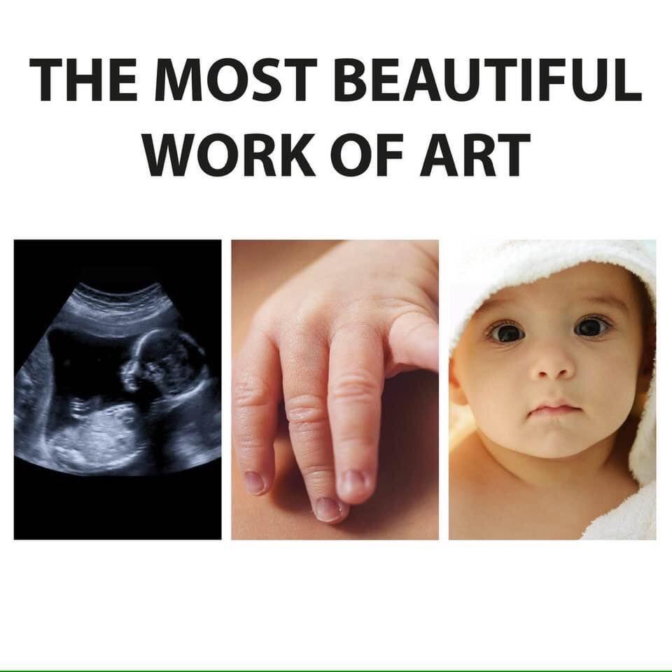 Susan (@emma6usa) on Twitter photo Pro Life - Protect All Unborn Babies. 👼🙏
<a href="/RockyMtMama1/">RockyMtMama</a>
<a href="/bitternesstojoy/">Bitternesstojoy</a>
<a href="/TrueTruthToday/">TrueTruth</a>
<a href="/TheFloridaMike/">Florida Mike: VanceGabbard2028</a>
<a href="/GaryWalters66/">Gary Walters</a>
<a href="/Melo95792935/">X_Adorn_X</a>
<a href="/SweetLouTiger/">SweetLou🍊</a>
<a href="/VirgoTheSixth/">🗣Virgo4Justice🇺🇸👮♂️🇮🇱🔥#🟦</a>
<a href="/Gentleman2741/">The Gentleman🎩</a>
<a href="/MagaPatriotHM/">PatriotHeather🇺🇸❤</a>
<a href="/IndyBeginsAt220/">I..AM INDY!</a>
<a href="/candace_lo70387/">🍭🍭Candace🍭🍭</a>
<a href="/CynthiaAli95222/">CTMAGA2020</a>
<a href="/JanetFr11616397/">Janet Frank</a> Pro Life - Protect All Unborn Babies. 👼🙏
<a href="/RockyMtMama1/">RockyMtMama</a>
<a href="/bitternesstojoy/">Bitternesstojoy</a>
<a href="/TrueTruthToday/">TrueTruth</a>
<a href="/TheFloridaMike/">Florida Mike: VanceGabbard2028</a>
<a href="/GaryWalters66/">Gary Walters</a>
<a href="/Melo95792935/">X_Adorn_X</a>
<a href="/SweetLouTiger/">SweetLou🍊</a>
<a href="/VirgoTheSixth/">🗣Virgo4Justice🇺🇸👮♂️🇮🇱🔥#🟦</a>
<a href="/Gentleman2741/">The Gentleman🎩</a>
<a href="/MagaPatriotHM/">PatriotHeather🇺🇸❤</a>
<a href="/IndyBeginsAt220/">I..AM INDY!</a>
<a href="/candace_lo70387/">🍭🍭Candace🍭🍭</a>
<a href="/CynthiaAli95222/">CTMAGA2020</a>
<a href="/JanetFr11616397/">Janet Frank</a>