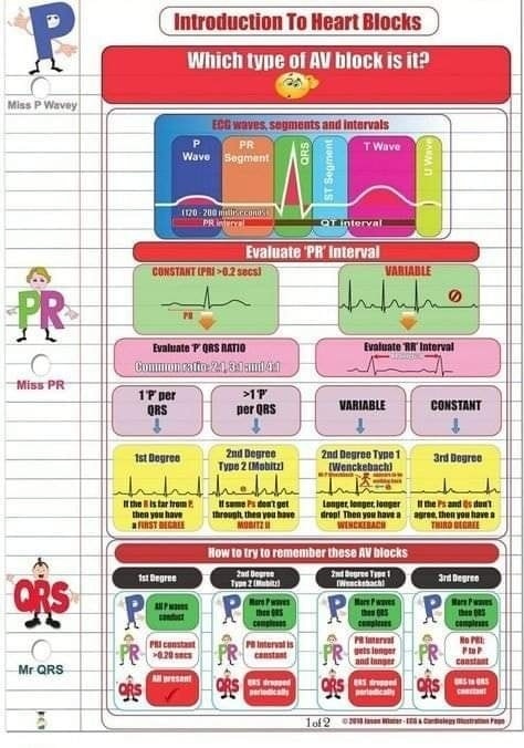 ZHeart11768530's tweet image. 🔴Heart Blocks/AV Block⤵️

 #MedStudentTwitter #Management #FOAMcc #Guidelines #CVD #cardiology #diagnosis #ECG #EKG #interpretation #MedEd #MedTwitter #QRS #diabetes #CardioEd #Cardiology #pharmacology #FOAMed #Cardiology #CardioEd #CardioTwitter #openaccess #august2023