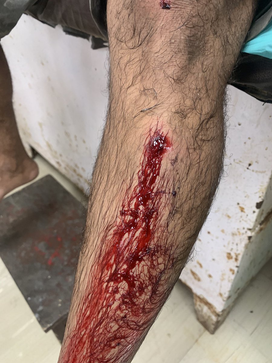 JamesonDsouza's tweet photo. @MumbaiPolice @DGPMaharashtra @Dev_Fadnavis @mieknathshinde @AmitShah @PMOIndia why malwani police is not writing my FIR https://t.co/grCdLAXAnT