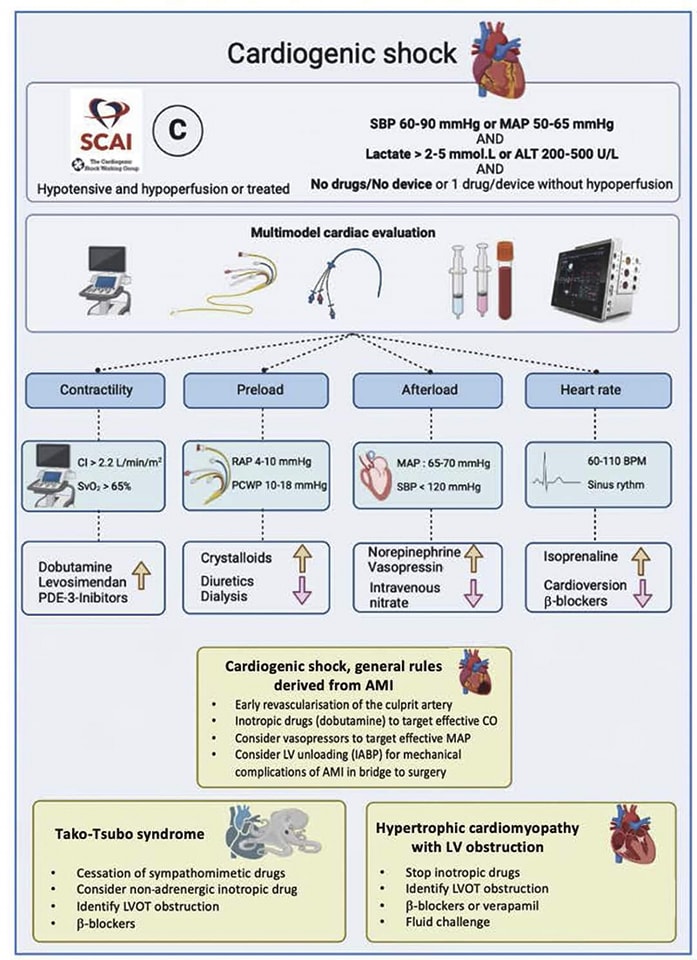 🔴 The Medical Treatment of Cardiogenic Shock #OpenAccess #Review 

🔹sciencedirect.com/science/articl… 
#CardioEd #CardioTwitter #cardiology #ECG #MedEd #cardiovascular #internalmedicine #EKG