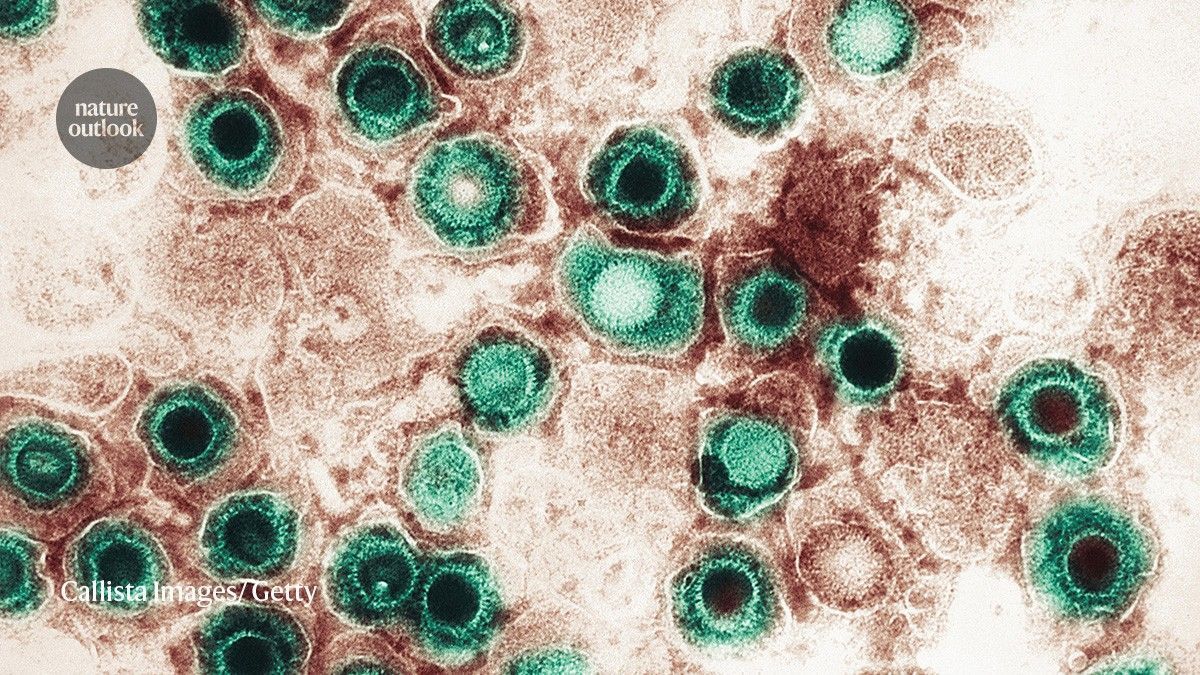 CCTSI (@cctsi) on Twitter photo Can infections outside the #brain fuel Alzheimer’s? Past CCTSI Pilot Grant Awardee Maria Nagel, MD, of <a href="/CUMedicalSchool/">CU School of Medicine</a> and other researchers see growing evidence linking systemic infections to #dementia risk. ▶️buff.ly/mRdJINR
<a href="/CUCenterOnAging/">CU Multidisciplinary Center on Aging</a> Can infections outside the #brain fuel Alzheimer’s? Past CCTSI Pilot Grant Awardee Maria Nagel, MD, of <a href="/CUMedicalSchool/">CU School of Medicine</a> and other researchers see growing evidence linking systemic infections to #dementia risk. ▶️buff.ly/mRdJINR
<a href="/CUCenterOnAging/">CU Multidisciplinary Center on Aging</a>