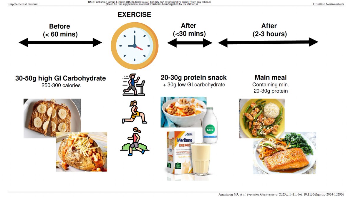 Frontline Gastro (@frontgastro_bmj) on Twitter photo โด๏ธ Brilliant โ informative review by <a href="/Drfattyliver/">Matthew Armstrong ๐</a> et al. on Frontline Gastroenterology. that ๐ก highlights the importance of evaluating the ๐ฅ nutritional status and ๐๏ธโโ๏ธ physical frailty of all patients with decompensated cirrhosis, โ provides clinical โ๏ธ tools to assess โด๏ธ Brilliant โ informative review by <a href="/Drfattyliver/">Matthew Armstrong ๐</a> et al. on Frontline Gastroenterology. that ๐ก highlights the importance of evaluating the ๐ฅ nutritional status and ๐๏ธโโ๏ธ physical frailty of all patients with decompensated cirrhosis, โ provides clinical โ๏ธ tools to assess