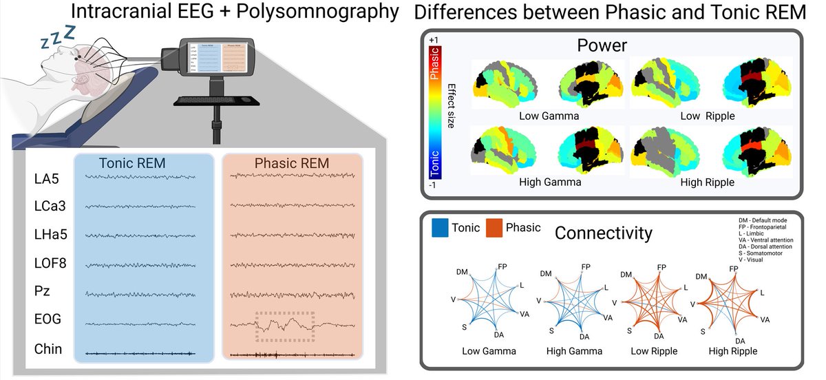 The AnPhy Lab (@anphylab) on Twitter photo REM sleep is not a monolith.... Phasic vs. tonic REM? Totally different vibes. 😎
Check out our new paper by <a href="/avigdortamir/">tamir avigdor</a> out in <a href="/ResearchSleep/">Sleep Research Society</a> 😴:
academic.oup.com/sleep/advance-… REM sleep is not a monolith.... Phasic vs. tonic REM? Totally different vibes. 😎
Check out our new paper by <a href="/avigdortamir/">tamir avigdor</a> out in <a href="/ResearchSleep/">Sleep Research Society</a> 😴:
academic.oup.com/sleep/advance-…
