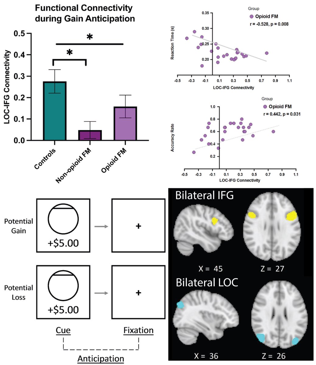 Katie Martucci PhD (@drkatiemartucci) on Twitter photo New #OpenAccess publication from our lab showing #brain differences in regions involved in #attention during a reward task in individuals with #fibromyalgia , with potential influence of pain duration and opioid use. <a href="/SciReports/">Scientific Reports</a>
nature.com/articles/s4159… New #OpenAccess publication from our lab showing #brain differences in regions involved in #attention during a reward task in individuals with #fibromyalgia , with potential influence of pain duration and opioid use. <a href="/SciReports/">Scientific Reports</a>
nature.com/articles/s4159…