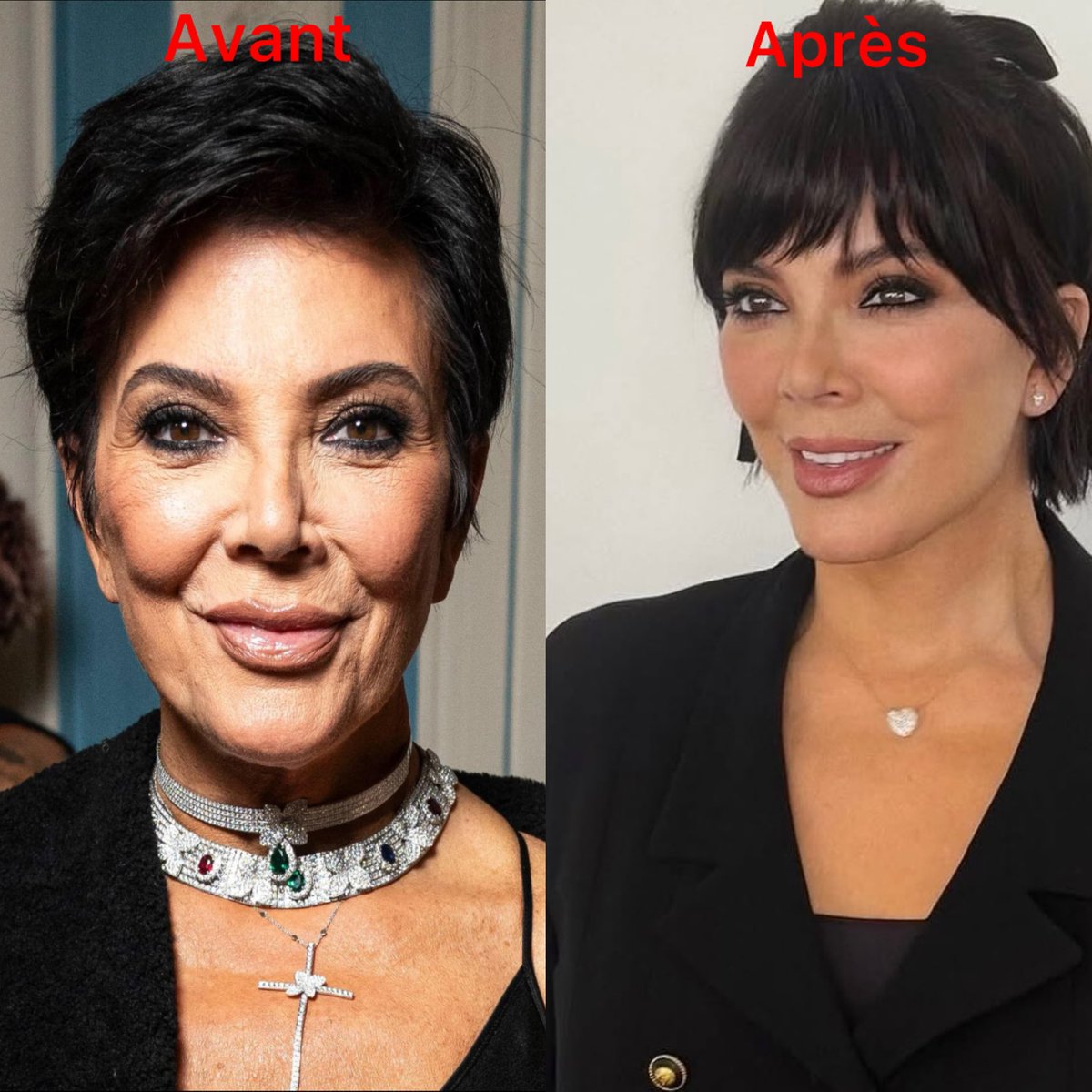 LeCelebrites's tweet photo. Kris Jenner AVANT et APRÈS. Elle a bientôt 28 ans. https://t.co/Xdh4SD8XKp