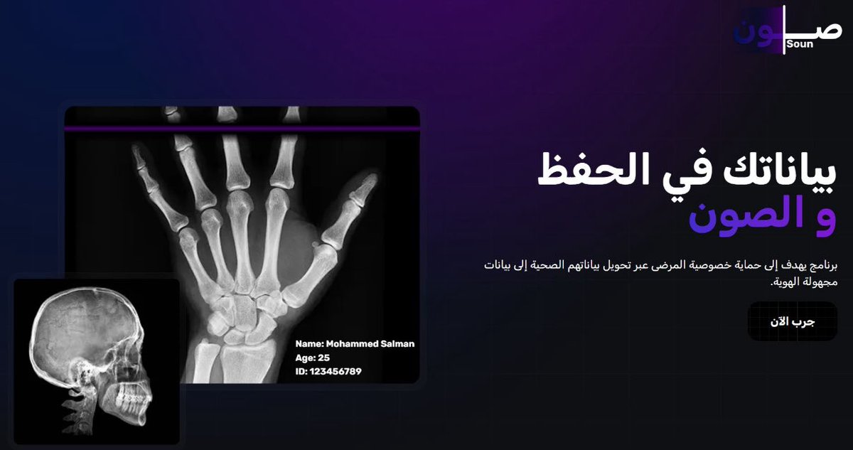 Congrats to our #KSU_SWE students for winning 2nd place at the #Healthon Hackathon with their project “Soun”, a smart tool for anonymizing radiology data!🥈

Proud of:
Mohammad Al-Omar | Hussam AlQannam | Zeyad Aldosari

#SWEHackathonHeroes 
#هاكاثون_الابتكار_الصحي