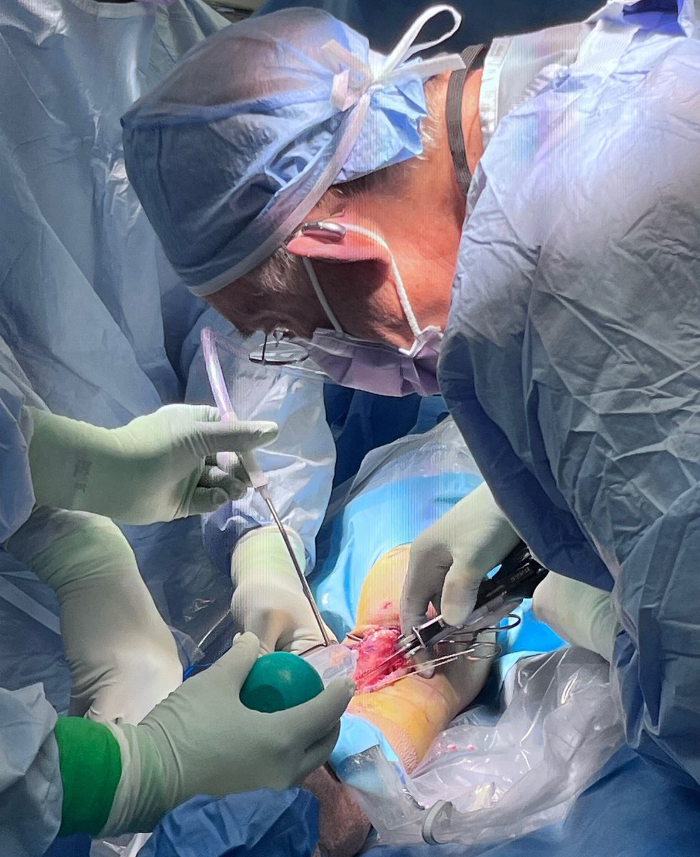 Contrary to rumor, I am not retired, but doing less surgery- now focussed on  3D custom TTO guides at Yale Orthopedics.