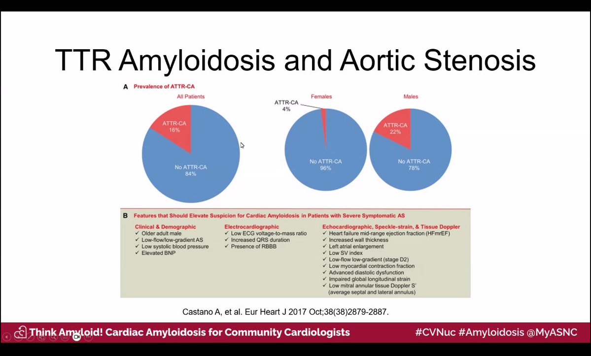 A.Sami Abuzaid MD,EMHL,FASE,FSCCT,FSCMR,FESC,FACC (@aabuzaiddr) on Twitter photo Is it not uncommon to find ATTR in aortic stenosis (AS)
ThinkAmyloid on your AS patients specially low flow low gradient AS, and TAVR
<a href="/MyASNC/">ASNC Society</a> #CVnuc Is it not uncommon to find ATTR in aortic stenosis (AS)
ThinkAmyloid on your AS patients specially low flow low gradient AS, and TAVR
<a href="/MyASNC/">ASNC Society</a> #CVnuc