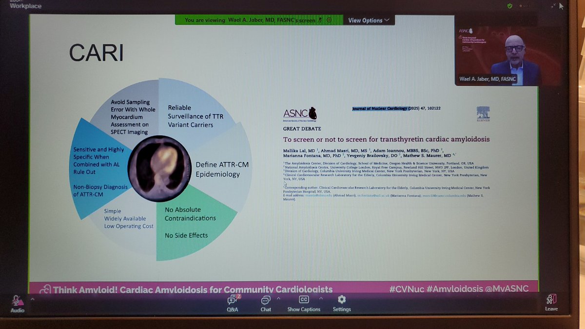 Rebecca A. Conley (@rconleya) on Twitter photo Halfway point on night 1 of 3 and still going strong with some great content! #ThinkAmyloid #CardiacAmyloidosis for Communiry Cardiologists #CVNuc #Amyloidosis <a href="/MyASNC/">ASNC Society</a> <a href="/MattersoftheH14/">Matters of the Heart 🫀</a> <a href="/Amyloidosisfdn/">Amyloidosis</a> #MedEd #Cardiology #CardioTwitter Halfway point on night 1 of 3 and still going strong with some great content! #ThinkAmyloid #CardiacAmyloidosis for Communiry Cardiologists #CVNuc #Amyloidosis <a href="/MyASNC/">ASNC Society</a> <a href="/MattersoftheH14/">Matters of the Heart 🫀</a> <a href="/Amyloidosisfdn/">Amyloidosis</a> #MedEd #Cardiology #CardioTwitter