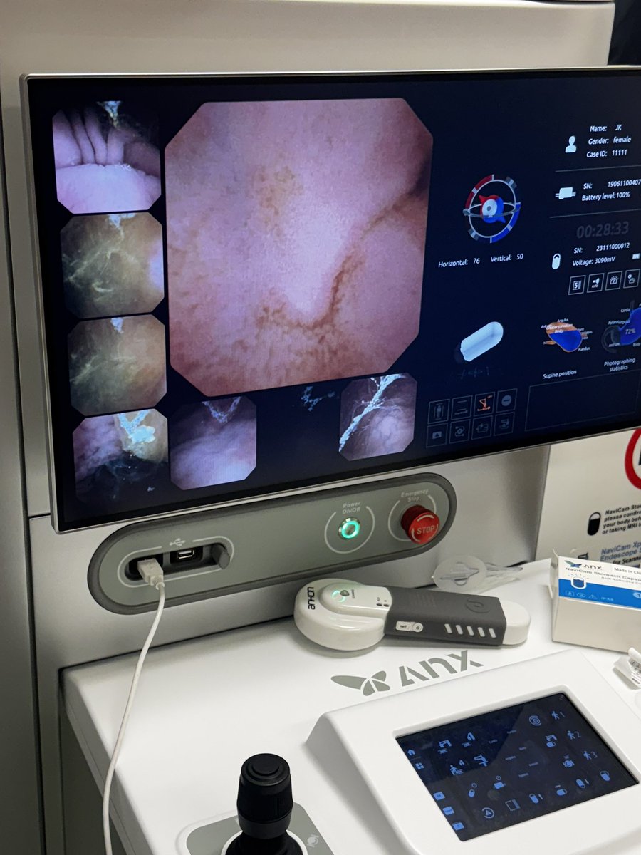 Jami Kinnucan, MD, FACG, AGAF, FCCF (@ibdgijami) on Twitter photo The things we do for friends and science to further innovation
<a href="/SwathiEluri/">Swathi Eluri MD MSCR</a> advancing our #esophageal research program and our practice with AnX Navicam technology for pts
I got to be one the early volunteers!
💩 yes those are my work slippers
✅ yes those are my villi! The things we do for friends and science to further innovation
<a href="/SwathiEluri/">Swathi Eluri MD MSCR</a> advancing our #esophageal research program and our practice with AnX Navicam technology for pts
I got to be one the early volunteers!
💩 yes those are my work slippers
✅ yes those are my villi!