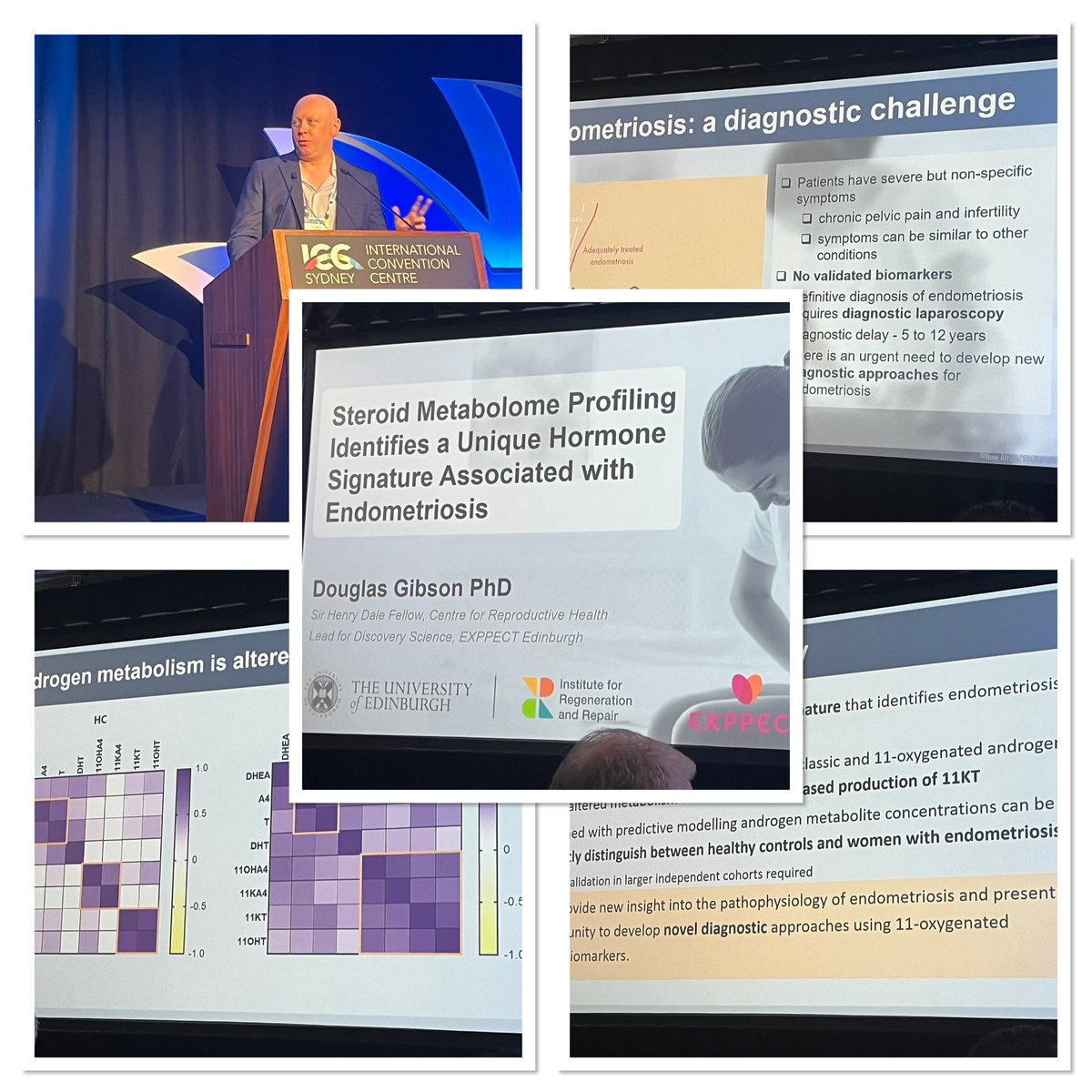 Andrew Horne (@horne_research) on Twitter photo Wonderful #wce2025 talk from <a href="/douglasagibson/">Douglas Gibson</a> from Centre for Reproductive Health at University of Edinburgh about his exciting work showing that women with endometriosis have a unique hormone signature - a potential novel non-invasive diagnostic test for #endometriosis <a href="/exppect/">EXPPECT Edinburgh</a> Wonderful #wce2025 talk from <a href="/douglasagibson/">Douglas Gibson</a> from Centre for Reproductive Health at University of Edinburgh about his exciting work showing that women with endometriosis have a unique hormone signature - a potential novel non-invasive diagnostic test for #endometriosis <a href="/exppect/">EXPPECT Edinburgh</a>