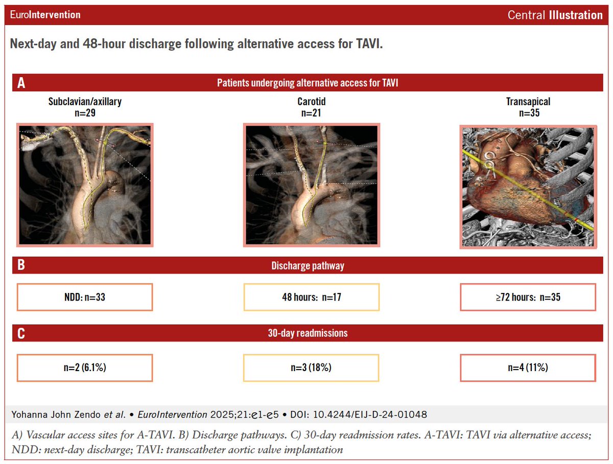 EuroIntervention (@eurointerventio) on Twitter photo #EuroPCR2025
A prospective study evaluating next-day and 48-hour discharge after alternative access #TAVI (subclavian/axillary, carotid, transapical) found no increase in 30-day readmission or mortality across discharge strategies.
<a href="/RodrigoBagur/">Rodrigo Bagur 🇦🇷🇨🇦</a>
#EAPCI #EuroPCR2025
A prospective study evaluating next-day and 48-hour discharge after alternative access #TAVI (subclavian/axillary, carotid, transapical) found no increase in 30-day readmission or mortality across discharge strategies.
<a href="/RodrigoBagur/">Rodrigo Bagur 🇦🇷🇨🇦</a>
#EAPCI