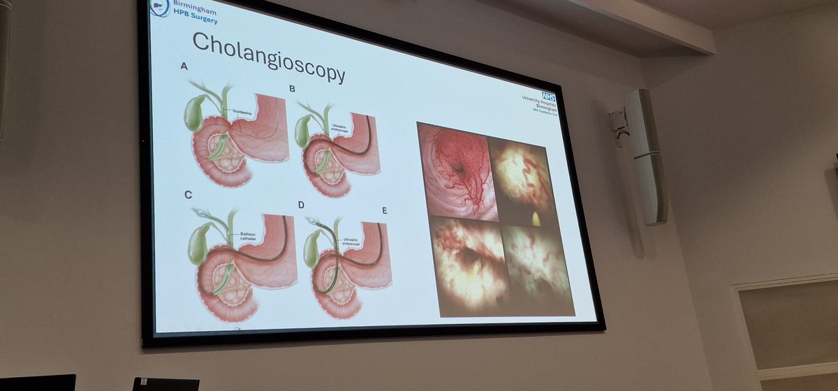 shivchavan's tweet image. 6th UHB LED/SAS Doctors annual Congress! Great talk on recent advances in the management of hepatobiliary cancer from Dr Pater Labib
@UHBMedAcademy @UmeshSalanke
@uhbtrust
