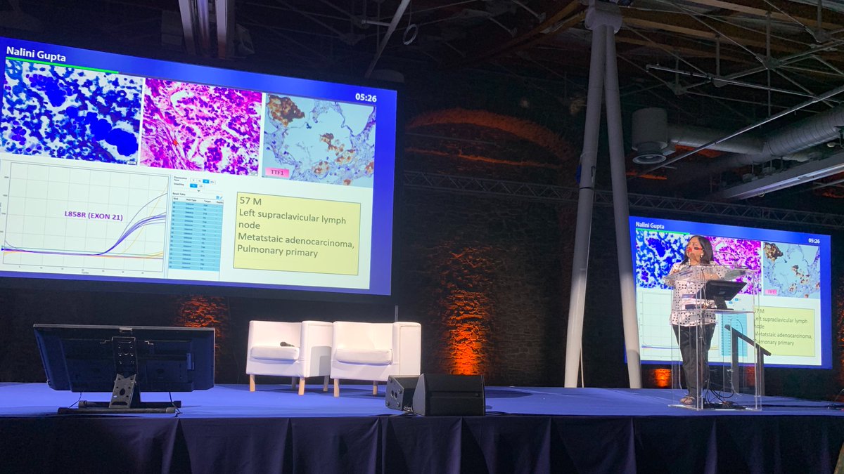 nalini203's tweet photo. Honoured to present our work on LN FNAC and other cytology topics at ICC Florence 2025. Grateful for the opportunity to contribute and engage with global experts at such a prestigious forum. #IACcongress @IACytology #PathTwitter #Cytopath #Cytology https://t.co/TfATyu35eF