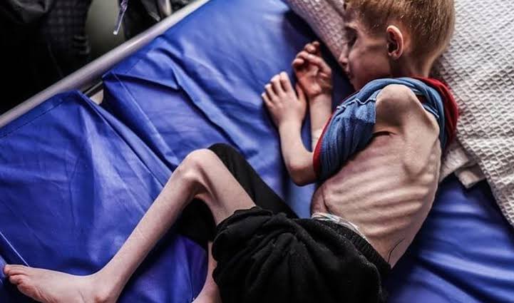 blusewillis2's tweet photo. Avete bisogno di alcune fotografie per capire il GENOCIDIO? #GazaGenocide‌ https://t.co/Pnlv8IbokD