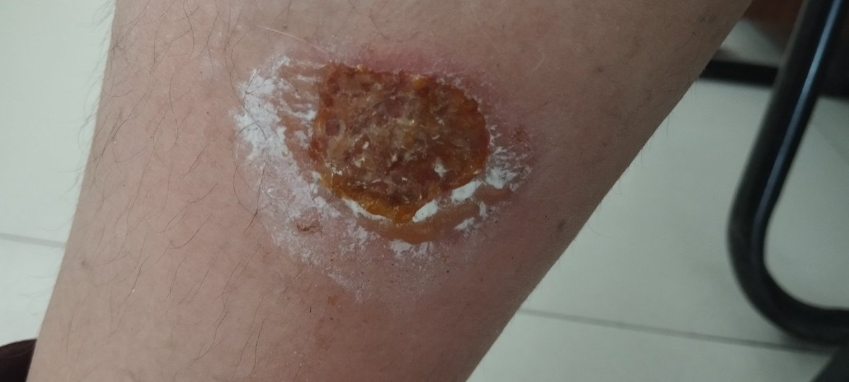 Al menos ya se manejar moto 😁✨