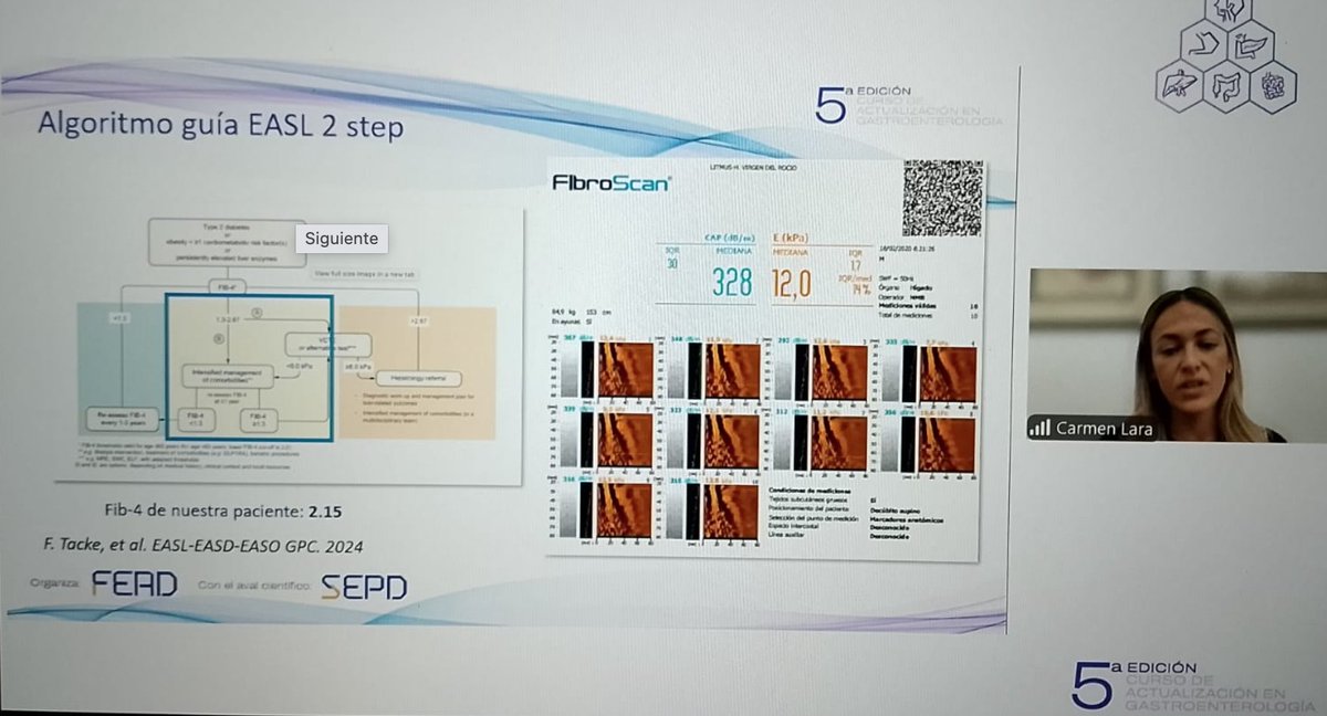 Sociedad Española de Patología Digestiva (SEPD) (@sepdigestiva) on Twitter photo #Formación #SEPD
👉Hoy se ha celebrado la 8ª Sesión clínica: 5ª Ed. Curso Actualización en Gastroenterología
👉“Enfermedad hepática metabólica (EHmet): avances en el tratamiento"
🔸Impartida por el Dr. <a href="/mromerogomez/">Manuel Romero-Gómez</a> y la Dra. Carmen Lara del <a href="/HospitalUVRocio/">HospitalUVRocio</a>, Sevilla.
Gracias #Formación #SEPD
👉Hoy se ha celebrado la 8ª Sesión clínica: 5ª Ed. Curso Actualización en Gastroenterología
👉“Enfermedad hepática metabólica (EHmet): avances en el tratamiento"
🔸Impartida por el Dr. <a href="/mromerogomez/">Manuel Romero-Gómez</a> y la Dra. Carmen Lara del <a href="/HospitalUVRocio/">HospitalUVRocio</a>, Sevilla.
Gracias