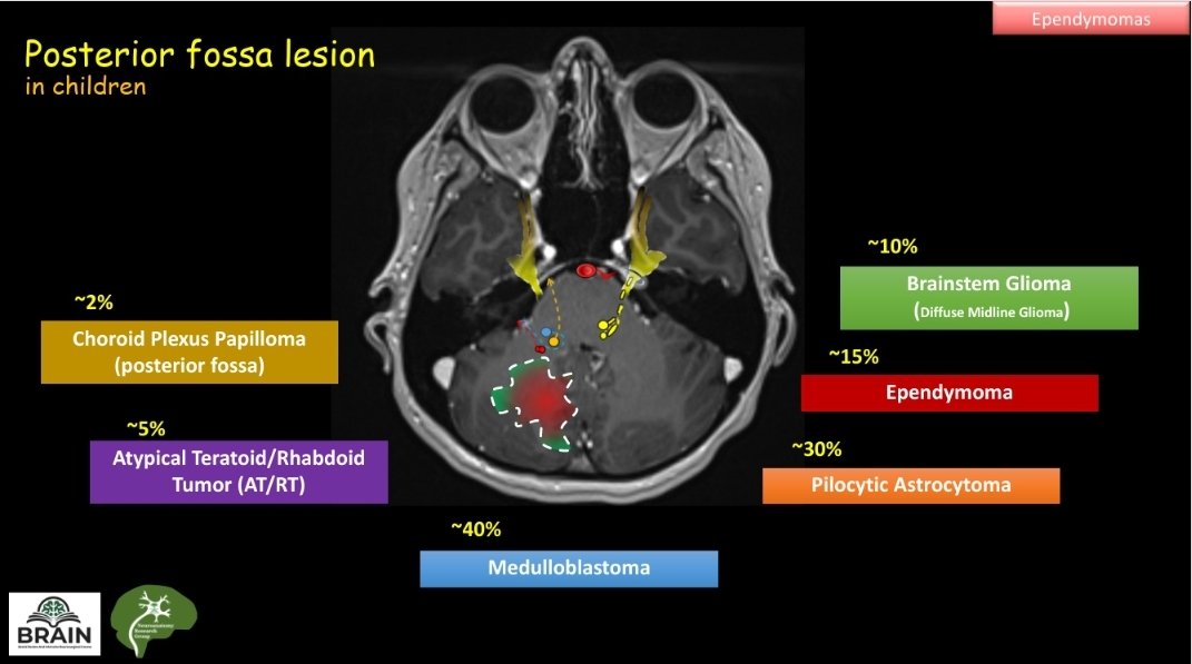 NeuroanatomyRG's tweet photo. On going now.. 
The BRAINᶜᵒᵘʳˢᵉ 2025 https://t.co/t5CYM6bPTG