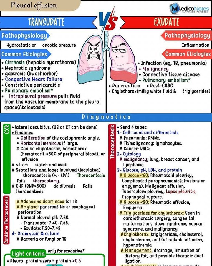 تجمع السوائل حول الرئة (Pleural Effusion) ممكن تنقسم لنوعين:
1. Transudate
2. Exudate

🌊 أولًا: Transudate
الـ Transudate تطلع لما يصير خلل في الضغط داخل الأوعية (hydrostatic أو oncotic)، يعني الجسم مو قادر يتحكم في توزيع الموية بشكل صحيح، فتهرب وتجمع حوالين الرئة.
🧠 الأسباب: