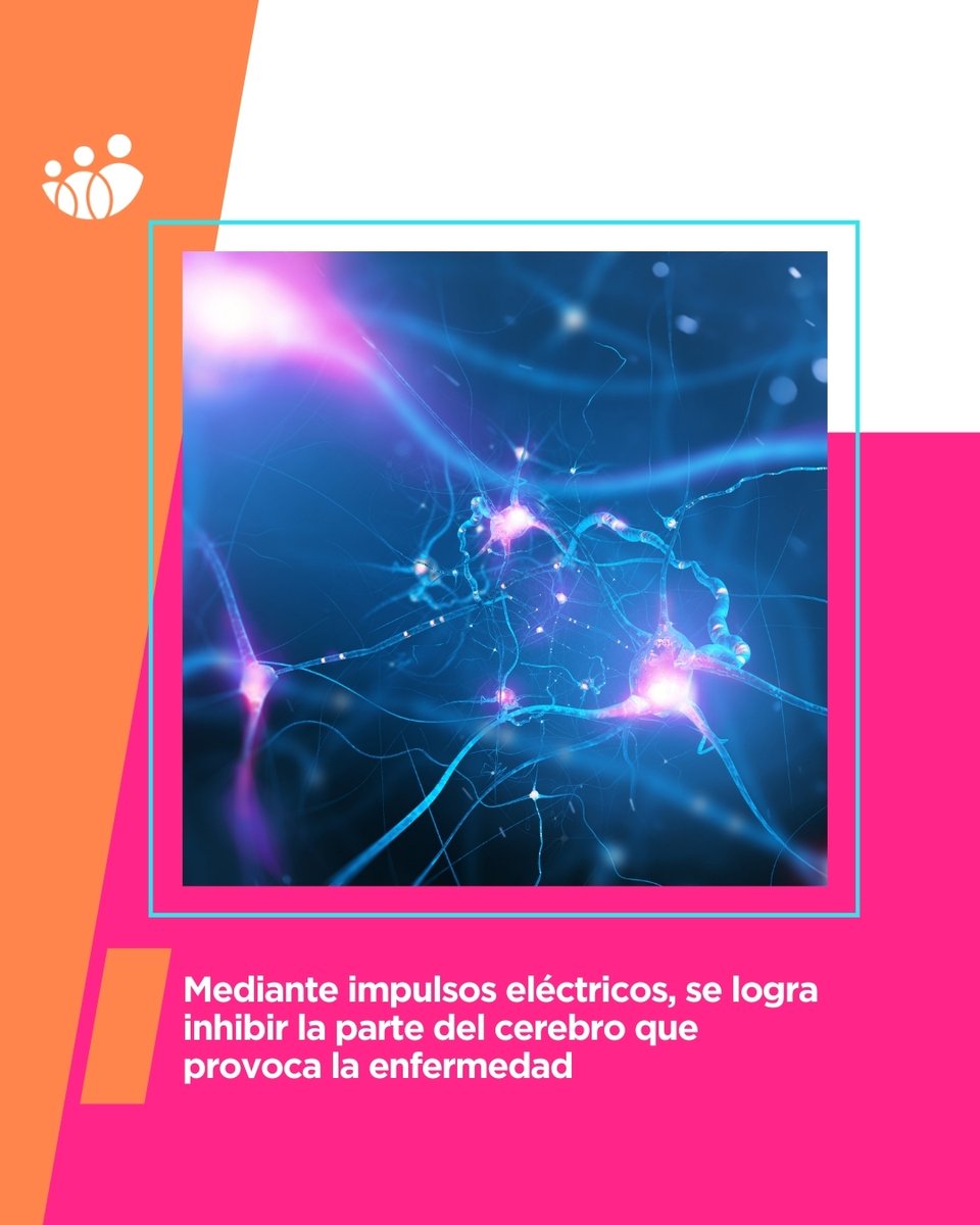 ACUNSA (@acunsa) on Twitter photo La medicación mejora los síntomas del párkinson, pero en ocasiones es insuficiente o produce efectos adversos. Aquí, la Cirugía del Párkinson es una alternativa muy eficaz. ¿Cómo es? Descúbrela con <a href="/ClinicaNavarra/">Clínica Universidad de Navarra</a>, centro pionero en España. bit.ly/2UE6m9Y La medicación mejora los síntomas del párkinson, pero en ocasiones es insuficiente o produce efectos adversos. Aquí, la Cirugía del Párkinson es una alternativa muy eficaz. ¿Cómo es? Descúbrela con <a href="/ClinicaNavarra/">Clínica Universidad de Navarra</a>, centro pionero en España. bit.ly/2UE6m9Y