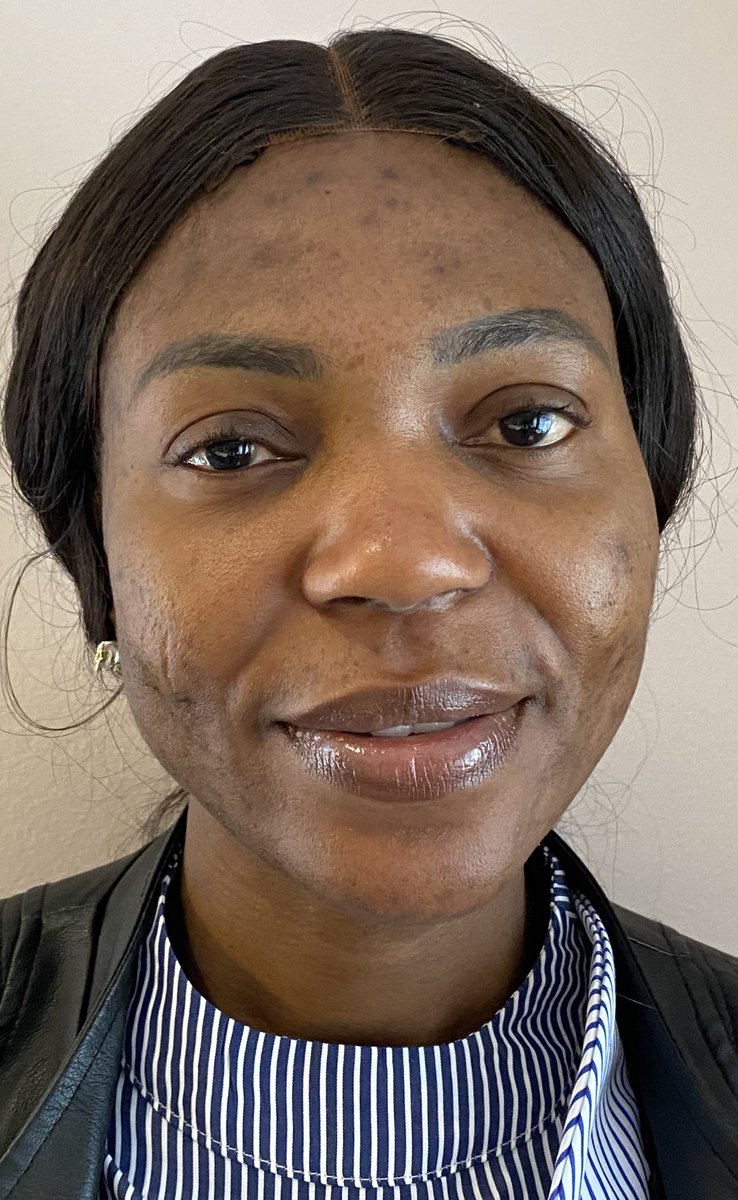 Thank you Dumebi for visiting our office to talk about volunteering at NUH