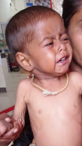 collectorUJN's tweet image. चरक भवन उज्जैन के पोषण पुनर्वास केन्द्र में निःशुल्क उपचार से 1 वर्षीय गौरव हुआ कुपोषण से मुक्त। 14 दिन में वजन 6.1kg से बढ़कर 7.28kg हुआ। अब गौरव स्वस्थ है और सामान्य जीवन जी रहा है। परिवार को ₹1680 प्रोत्साहन राशि भी दी गई।
#PoshanAbhiyan #MPHealth