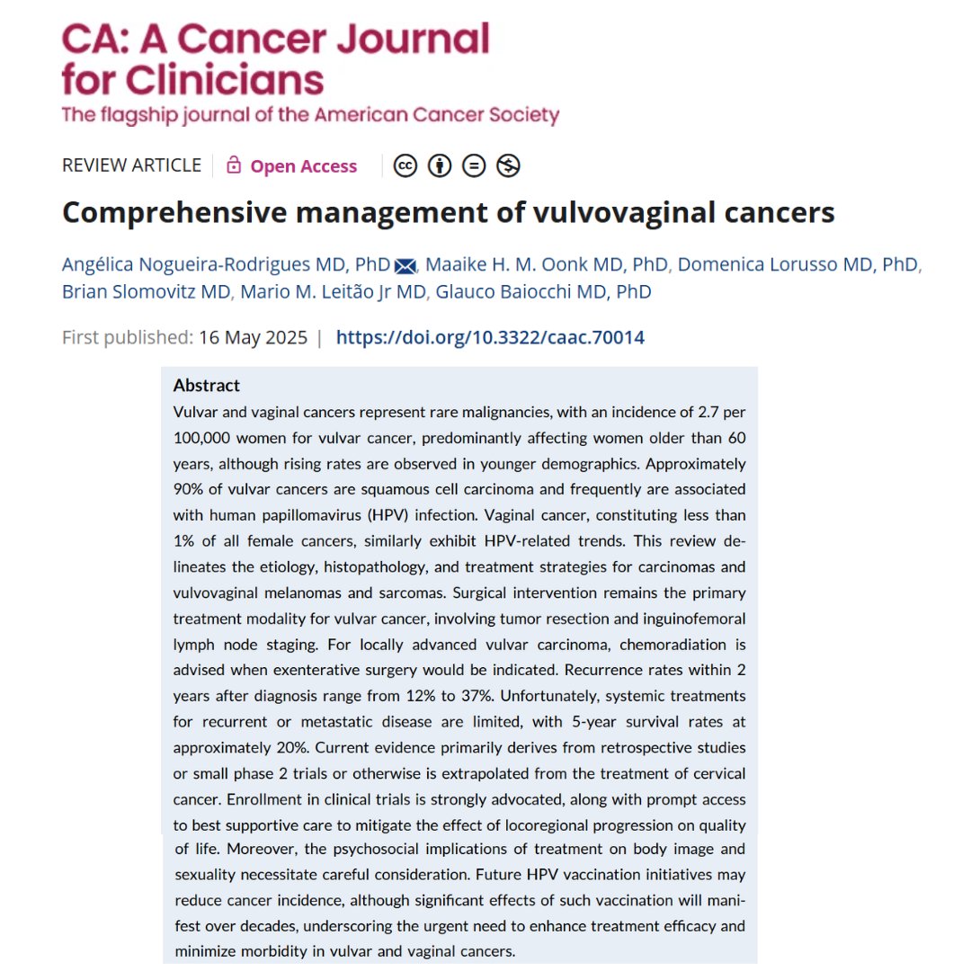 CA: A Cancer Journal for Clinicians (@cacancerjournal) on Twitter photo Enrollment in clinical trials is strongly advocated for patients with vulvovaginal cancers, along with prompt access to supportive care to mitigate effect of locoregional progression on QOL. acsjournals.onlinelibrary.wiley.com/doi/full/10.33…
<a href="/OncoAlert/">OncoAlert</a> <a href="/glaucobaiocchi/">Glauco Baiocchi</a> <a href="/GynCancerMD/">Brian Slomovitz, MD, MS, FACOG</a> <a href="/angelica_onco/">Angelica Nogueira Rodrigues</a> #gyncsm Enrollment in clinical trials is strongly advocated for patients with vulvovaginal cancers, along with prompt access to supportive care to mitigate effect of locoregional progression on QOL. acsjournals.onlinelibrary.wiley.com/doi/full/10.33…
<a href="/OncoAlert/">OncoAlert</a> <a href="/glaucobaiocchi/">Glauco Baiocchi</a> <a href="/GynCancerMD/">Brian Slomovitz, MD, MS, FACOG</a> <a href="/angelica_onco/">Angelica Nogueira Rodrigues</a> #gyncsm