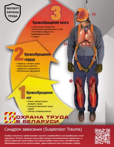 Многие считают, что после остановки падения с высоты угроза миновала. Однако физиологические исследования показывают, что критическое состояние может развиться быстрее, чем прибудет помощь. Давайте разбираться
otb.by/articles/sindr…

#явбезопасности #SuspensionTrauma