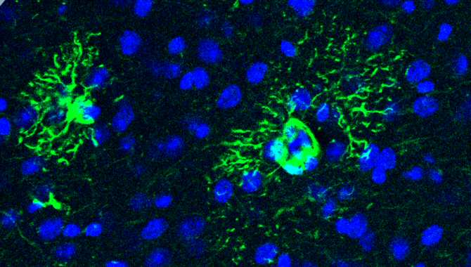 Capaces.News (@capacesnews) on Twitter photo #Investigación #Ciencia #Nerología Cambios tempranos en el cerebro que anticipan el #alzhéimer, vía <a href="/CBM_CSIC_UAM/">Centro de Biología Molecular Severo Ochoa</a> <a href="/ncytnotesp/">Amazings - NCYT</a>. noticiasdelaciencia.com/art/54048/camb… #Investigación #Ciencia #Nerología Cambios tempranos en el cerebro que anticipan el #alzhéimer, vía <a href="/CBM_CSIC_UAM/">Centro de Biología Molecular Severo Ochoa</a> <a href="/ncytnotesp/">Amazings - NCYT</a>. noticiasdelaciencia.com/art/54048/camb…