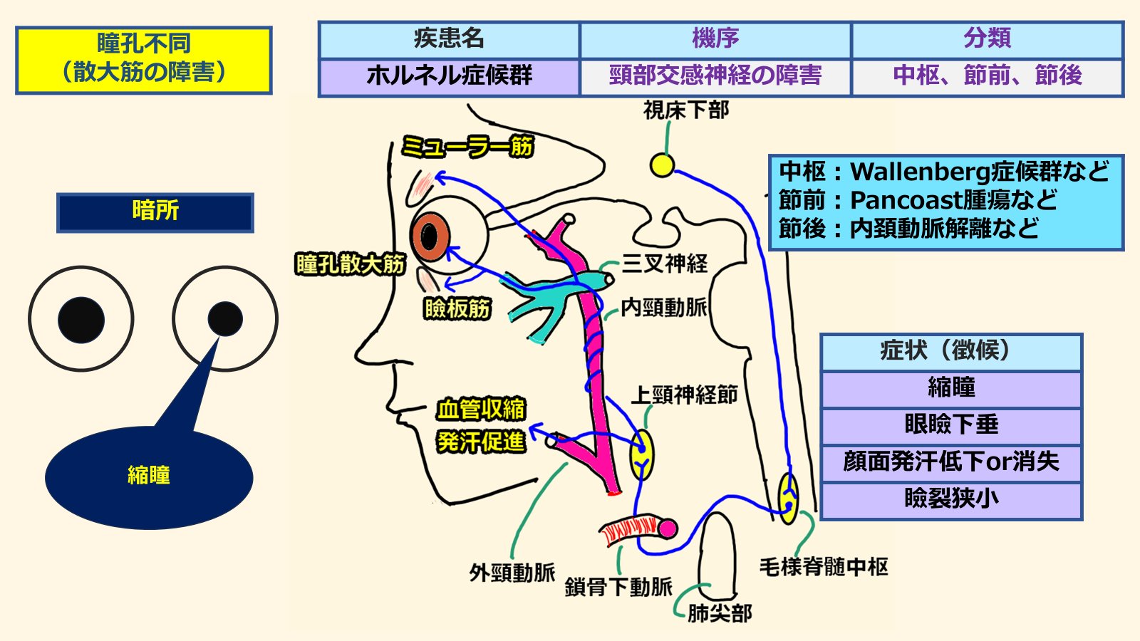 眼のサイエンス 眼疾患の謎 眼のサイエンス 視覚の不思議 | 株式会社文光堂