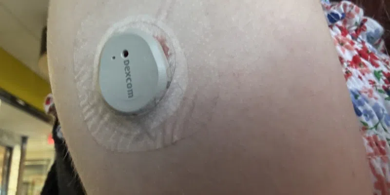 VOCMNEWS's tweet photo. Government Expanding Glucose Monitoring Program to Include All Type 1 Diabetics

https://t.co/54v0oN5xUR https://t.co/4S8kUt8pWH