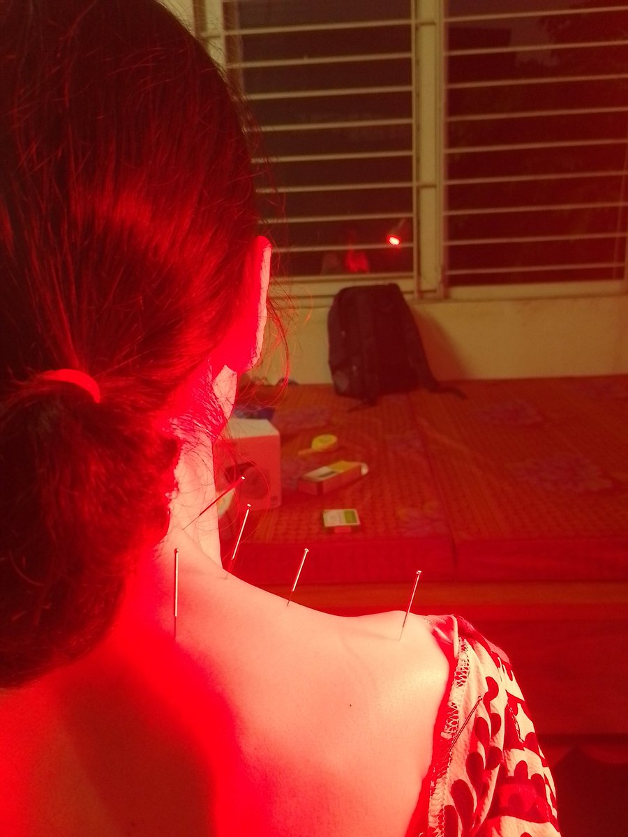 Châm cứu là một phương pháp khá hiệu quả trong việc trị bệnh. Nó được ví như mổ sẻ ngoại khoa của Tây Y. Đòi hỏi người dùng phải thành thạo về hệ thống kinh lạc và lý luận chặt chẽ của Đông Y. Ngoài ra người dùng cần phải cẩn thận và tỷ mỉ trong