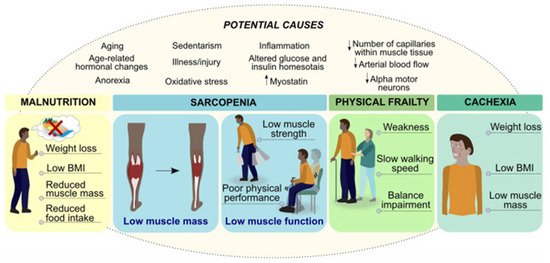 🔬 RicardoMontes (@_mcricardo_) on Twitter photo The Role of the Mediterranean Diet in the Prevention of Sarcopenia & Frailty in Older Adults
High adherence to the MD may delay the onset of sarcopenia & improve muscle function in older adults.
mdpi.com/2072-6643/17/1… <a href="/dronita_de/">Ronita De, PhD</a> <a href="/drfherediaz/">fausto heredia z.</a> <a href="/guani_vic/">Sagittarius🧠🌞</a> <a href="/HealthyFellow/">J P Fanton</a> The Role of the Mediterranean Diet in the Prevention of Sarcopenia & Frailty in Older Adults
High adherence to the MD may delay the onset of sarcopenia & improve muscle function in older adults.
mdpi.com/2072-6643/17/1… <a href="/dronita_de/">Ronita De, PhD</a> <a href="/drfherediaz/">fausto heredia z.</a> <a href="/guani_vic/">Sagittarius🧠🌞</a> <a href="/HealthyFellow/">J P Fanton</a>