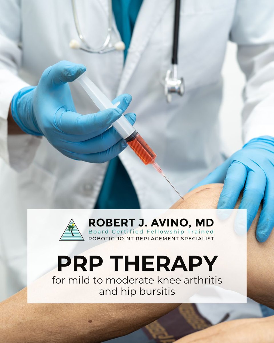 Did you know Dr. Avino offers #PRPTherapy for mild to moderate #kneearthritis &amp; #hipbursitis? PRP is a non-surgical treatment that uses a concentrated form of your own blood to deliver growth factors directly to injured area, supporting targeted healing &amp; longer-lasting relief.