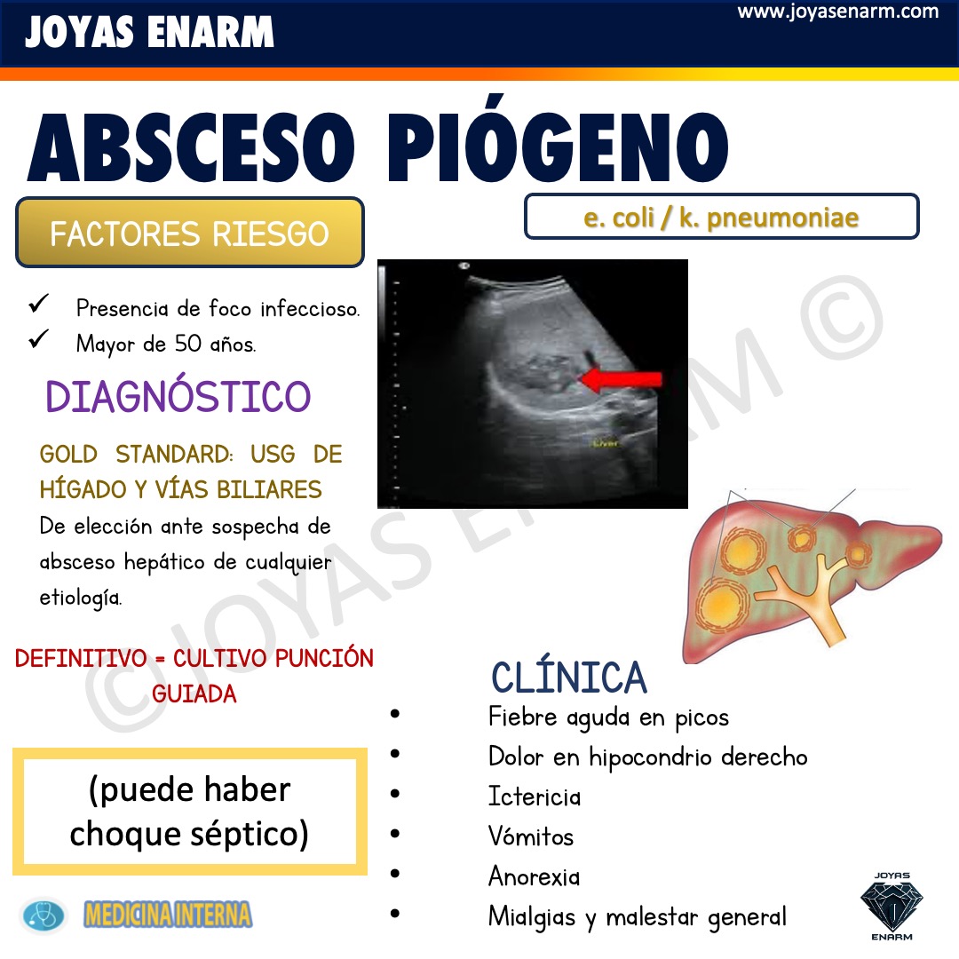 Absceso Hepático - Amebiano &amp; Piógeno 📷 Tema Clásico del #ENARM
#ENARM2025 

Obtén TODOS los temas resumidos de forma PUNTUAL Y DIRECTA que te ayudarán a obtener la mejor calificación para el #ENARM
📷 Disponible en: joyasenarm.com 📷