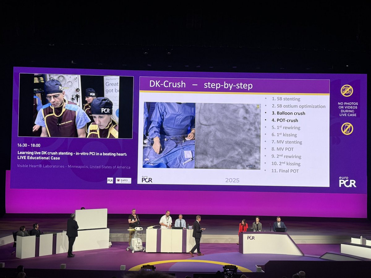 Outside of the Box ๐ญ๐ท๐ช๐บ (@josipaborovac) on Twitter photo ๐ซ๐ฅ๐ฅBrilliant demonstration of DK-Crush in a beating โVisible Heart 3Dโ model by <a href="/MHIF_Heart/">Minneapolis Heart Institute Foundation</a> <a href="/esbrilakis/">Emmanouil Brilakis</a> - a session that is truly โmust-attendโ. Amazing experience with best in the world panel on this issue <a href="/GoranEBC/">Goran Stankovic, MD, PhD</a> <a href="/BURZOTTA_F/">FRANCESCO BURZOTTA</a> <a href="/NievesGonzalo1/">Nieves Gonzalo</a> <a href="/gabor_gt/">Gabor G Toth</a> <a href="/PCRonline/">PCRonline ๐ซ</a> #EuroPCR ๐ซ๐ฅ๐ฅBrilliant demonstration of DK-Crush in a beating โVisible Heart 3Dโ model by <a href="/MHIF_Heart/">Minneapolis Heart Institute Foundation</a> <a href="/esbrilakis/">Emmanouil Brilakis</a> - a session that is truly โmust-attendโ. Amazing experience with best in the world panel on this issue <a href="/GoranEBC/">Goran Stankovic, MD, PhD</a> <a href="/BURZOTTA_F/">FRANCESCO BURZOTTA</a> <a href="/NievesGonzalo1/">Nieves Gonzalo</a> <a href="/gabor_gt/">Gabor G Toth</a> <a href="/PCRonline/">PCRonline ๐ซ</a> #EuroPCR