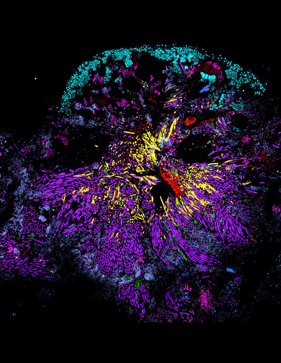 ForsythResearch's tweet image. We're honored that an AFI image was recognized by @IADR for The Journal of Dental Research @JDentRes cover of the year!
The image was captured by AFI's very own Drs. Tabita Ramirez-Puebla, Jessica Mark Welch, and Gary Borisy.
Learn more: ow.ly/ueYj50VX8Jc