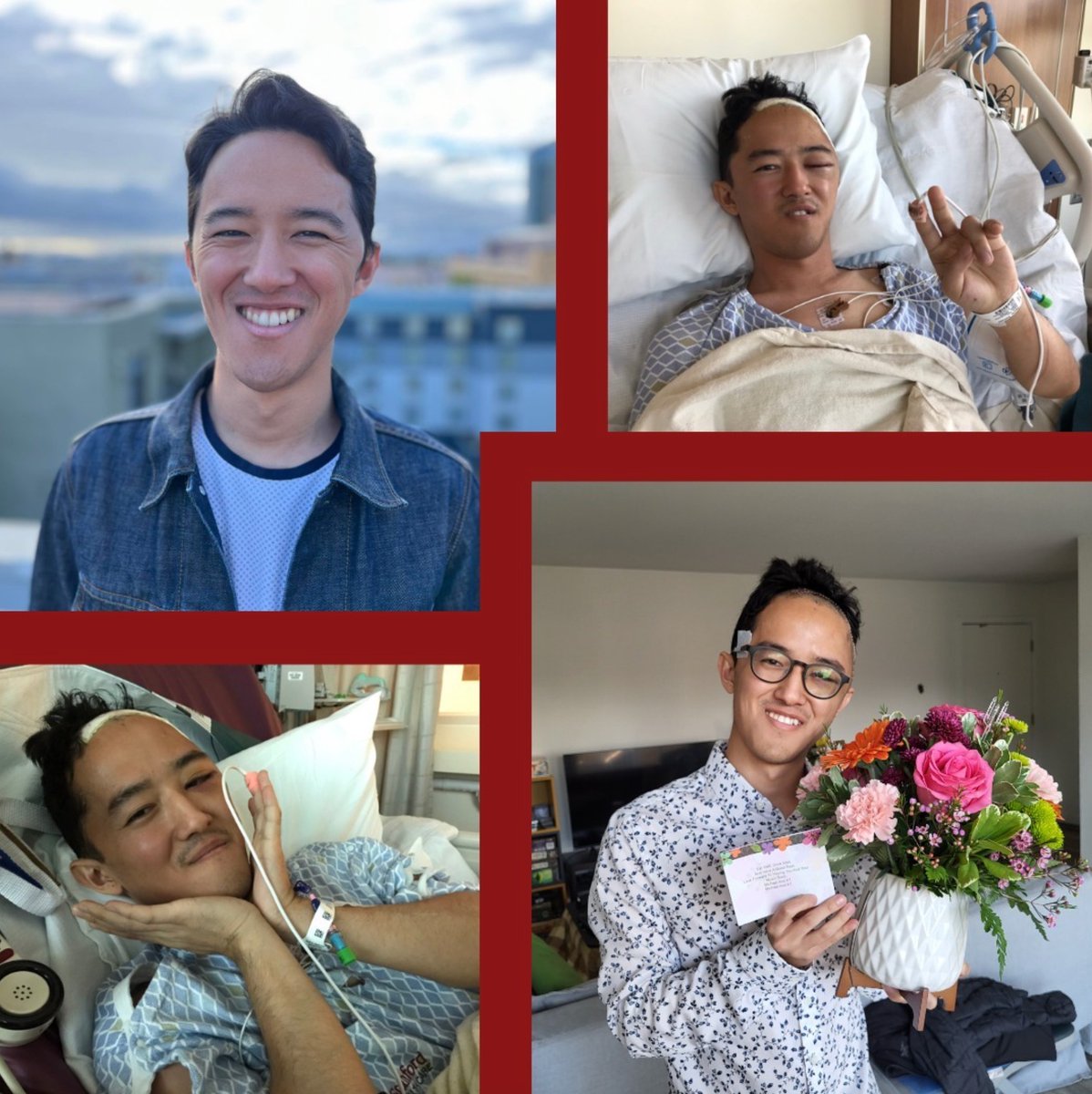 Stanford Brain Tumor Center (@stanfordbraintc) on Twitter photo In 2022, Tomoya Ogura, an Oakland-based software engineer, started having pain on the left side of his face. Imaging found a brain tumor pressing on his trigeminal nerve.
Read more on Tomoya's journey and care with <a href="/MichaelLimMD/">Michael Lim, MD</a> and our Stanford team:
med.stanford.edu/brain-tumor/pa… In 2022, Tomoya Ogura, an Oakland-based software engineer, started having pain on the left side of his face. Imaging found a brain tumor pressing on his trigeminal nerve.
Read more on Tomoya's journey and care with <a href="/MichaelLimMD/">Michael Lim, MD</a> and our Stanford team:
med.stanford.edu/brain-tumor/pa…