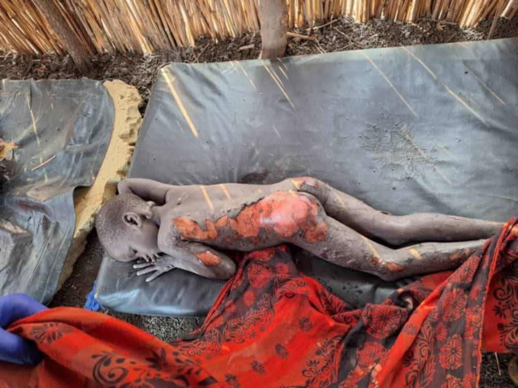 PalMai8's tweet photo. It is unjust to talk about the R-ARCSS and not about the ongoing genocide of the Nuers killed by the regime and Ugandan mercenaries.
What the Nuers are undergoing is the like of Rwanda's genocide, Holocaust and other atrocities committed in the past. 
Justic will prevail. https://t.co/MvBGnPzzoy