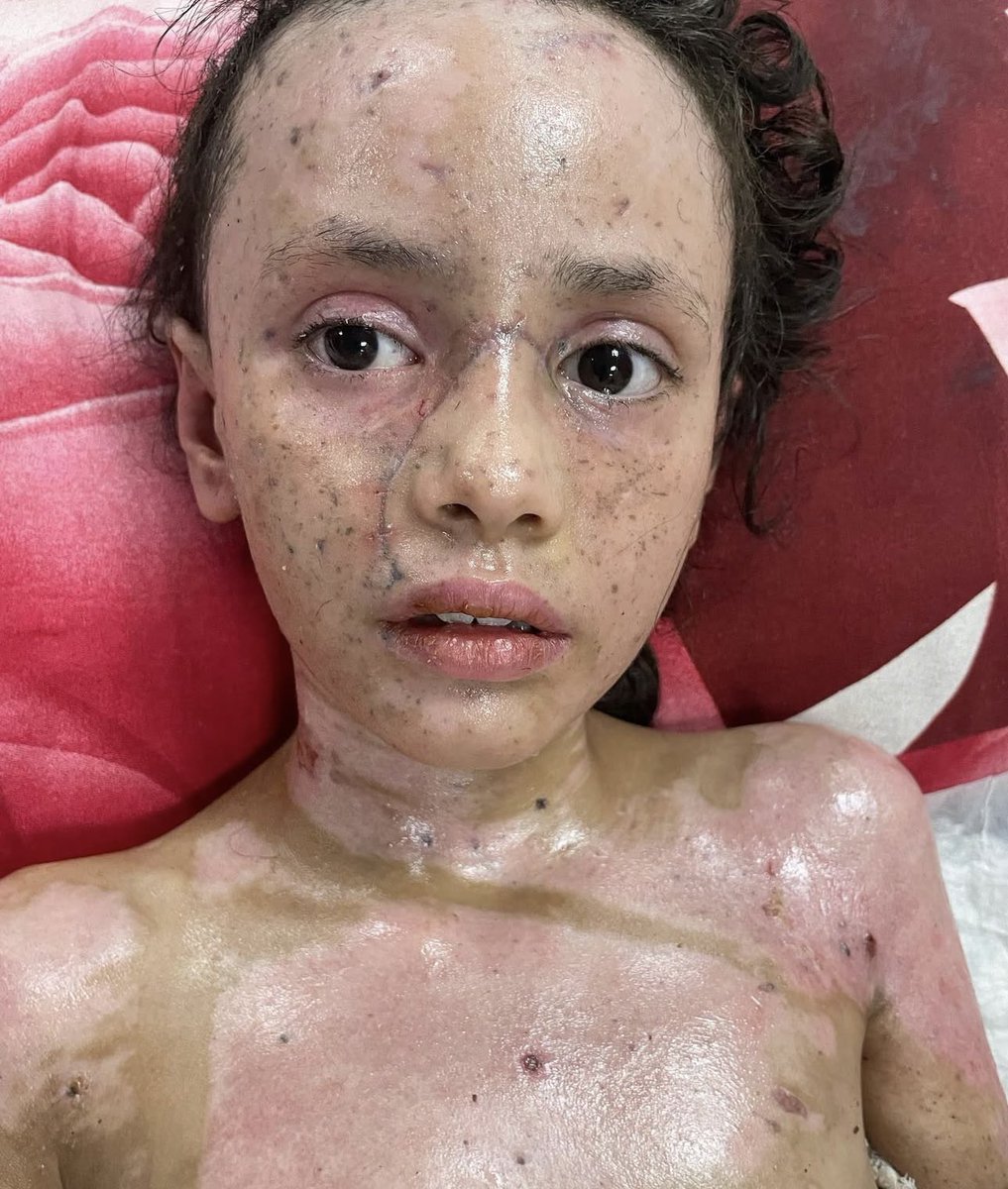 Drop a ❤️ for this little angel! 🇵🇸
Pray for her, don't stop talking about our children!