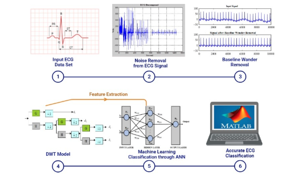 JMC_journal's tweet image. Computational Framework for Prediction of Cardiac Disorders by Analyzing ECG Signals Using Machine Learning Technique

dl.begellhouse.com/journals/61fd1…

#CardiacAI #ECGAnalysis #MachineLearning #PredictiveModeling
