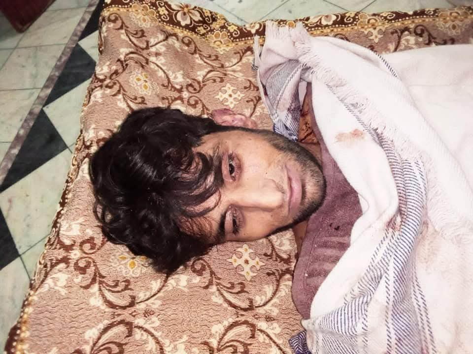 Sardar Nasir Aziz KHAN (@nasirkhanukpnp) on Twitter photo Another young #Kashmiri Raja Qaiser Rasheed, allegedly killed in police custody in #Rawalpindi #Pakistan after arrest in #Muzaffarabad. #UKPNP strongly condemns this extrajudicial killing and demands justice, accountability & support for the victim’s family.
<a href="/shaukatkashmiri/">Shaukat Ali Kashmiri</a> Another young #Kashmiri Raja Qaiser Rasheed, allegedly killed in police custody in #Rawalpindi #Pakistan after arrest in #Muzaffarabad. #UKPNP strongly condemns this extrajudicial killing and demands justice, accountability & support for the victim’s family.
<a href="/shaukatkashmiri/">Shaukat Ali Kashmiri</a>