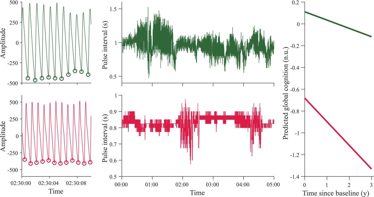 JAHA (@jaha_aha) on Twitter photo Lower cardiac autonomic complexity, measured via pulse rate entropy, predicts faster cognitive decline in older adults. #AHAJournals <a href="/AgustinMIbanez/">Agustin Ibañez</a> <a href="/BrainlatUAI/">BrainLat UAI</a> <a href="/UAI_CL/">UAI</a> <a href="/KunHu_MBP/">KH</a> <a href="/PengLiBME/">Peng Li</a> <a href="/harvardmed/">Harvard Medical School</a> ahajrnls.org/4k2lngU Lower cardiac autonomic complexity, measured via pulse rate entropy, predicts faster cognitive decline in older adults. #AHAJournals <a href="/AgustinMIbanez/">Agustin Ibañez</a> <a href="/BrainlatUAI/">BrainLat UAI</a> <a href="/UAI_CL/">UAI</a> <a href="/KunHu_MBP/">KH</a> <a href="/PengLiBME/">Peng Li</a> <a href="/harvardmed/">Harvard Medical School</a> ahajrnls.org/4k2lngU