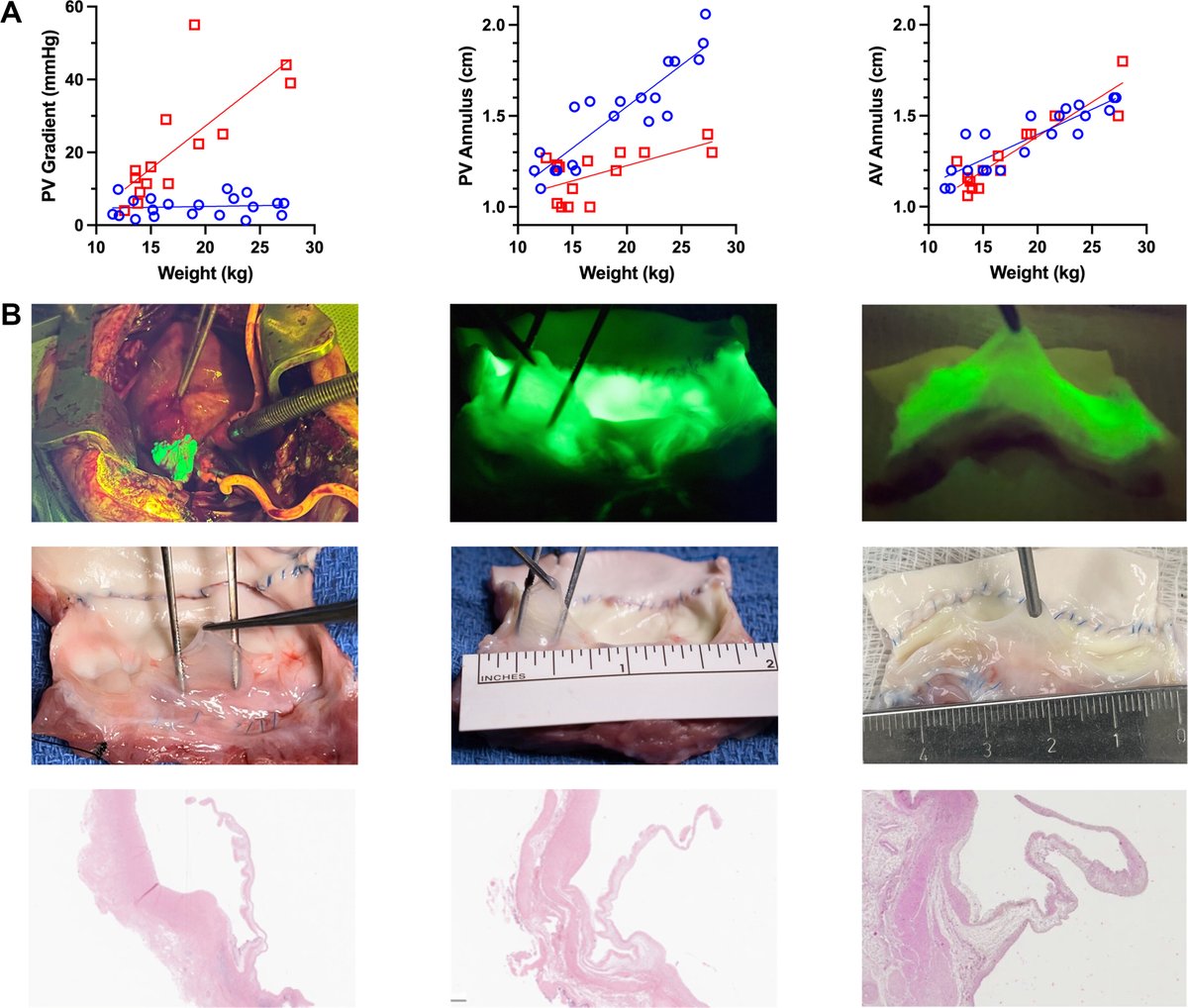 JACCJournals's tweet image. In this #JACCBTS research letter, Dr. Lillian Kang et al. provide data from their experience with partial heart transplant in piglets as an alternative to homografts for valve replacement. jacc.org/doi/10.1016/j.…

#Hearttx #CHD #BasicScience #TranslationalScience