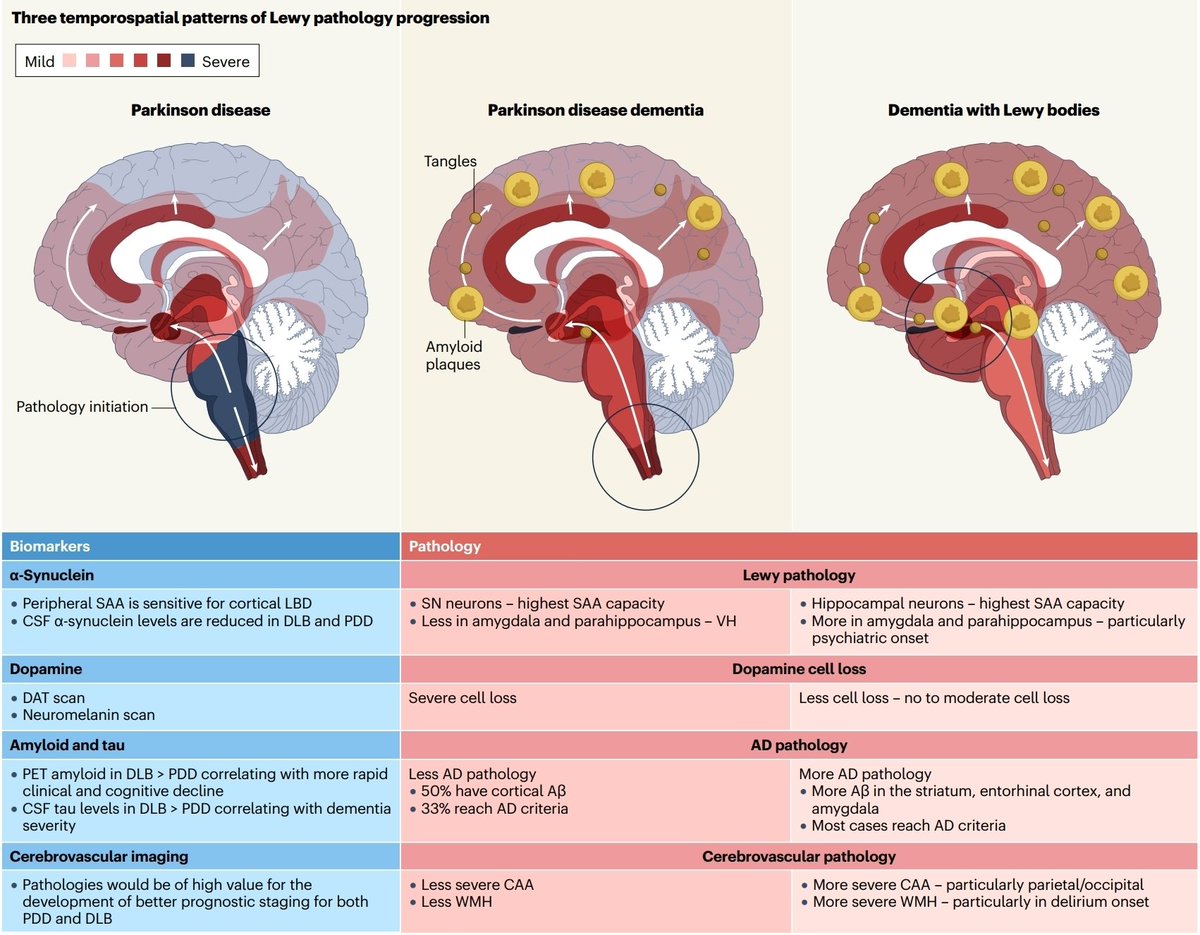 dr_heli's tweet image. Dementia with lewy bodies and Parkinson disease dementia- same or different and is it important? @NatRevNeurol
doi.org/10.1038/s41582…