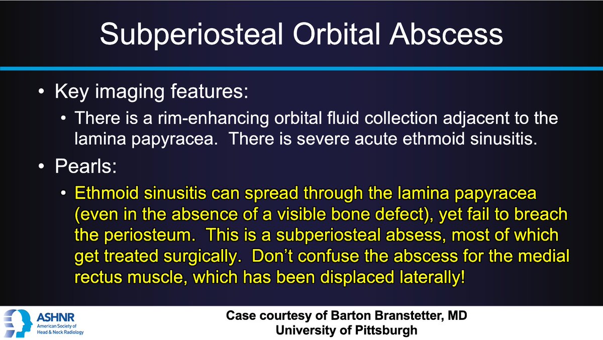 ASHNR (@ashnrsociety) on Twitter photo #ASHNRCOTW #298: ANSWER. Thx
<a href="/CharBranstetter/">Char Branstetter</a> 4 case! #ASHNR25
<a href="/callyrobs/">Caroline Robson, MBChB</a> <a href="/DShatzkes/">Deborah Shatzkes</a> <a href="/CDP_Rad/">C Douglas Phillips 🇺🇸</a> <a href="/rhwiggins/">Richard Wiggins</a>
<a href="/nakoontz/">Nicholas Koontz</a> <a href="/KRileyMD/">Kalen Riley</a> <a href="/CMGlastonbury/">Christine M Glastonbury, MD</a> <a href="/tabby_kennedy/">Tabby A. Kennedy, MD</a> <a href="/PhilipRChapman1/">Philip R. Chapman, MD</a> <a href="/cmtomblinson/">Courtney Tomblinson, MD</a>
<a href="/amyfjuliano/">Amy Juliano</a> @bpolicen <a href="/MohitTCCNeuro/">Mohit Agarwal</a> <a href="/AshokSrini15/">Ashok Srinivasan</a> <a href="/KatieTraylorDO/">Katie S. Traylor MS, DO, DABR</a> <a href="/CynXinWu/">Cynthia Xin Wu</a> #ASHNRCOTW #298: ANSWER. Thx
<a href="/CharBranstetter/">Char Branstetter</a> 4 case! #ASHNR25
<a href="/callyrobs/">Caroline Robson, MBChB</a> <a href="/DShatzkes/">Deborah Shatzkes</a> <a href="/CDP_Rad/">C Douglas Phillips 🇺🇸</a> <a href="/rhwiggins/">Richard Wiggins</a>
<a href="/nakoontz/">Nicholas Koontz</a> <a href="/KRileyMD/">Kalen Riley</a> <a href="/CMGlastonbury/">Christine M Glastonbury, MD</a> <a href="/tabby_kennedy/">Tabby A. Kennedy, MD</a> <a href="/PhilipRChapman1/">Philip R. Chapman, MD</a> <a href="/cmtomblinson/">Courtney Tomblinson, MD</a>
<a href="/amyfjuliano/">Amy Juliano</a> @bpolicen <a href="/MohitTCCNeuro/">Mohit Agarwal</a> <a href="/AshokSrini15/">Ashok Srinivasan</a> <a href="/KatieTraylorDO/">Katie S. Traylor MS, DO, DABR</a> <a href="/CynXinWu/">Cynthia Xin Wu</a>