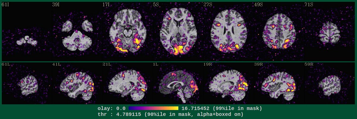 **FMRI/neuroimaging folks**

Quick reminder @ the next AFNI Bootcamp: May 28-30, 2025. Learn through interactive data analysis!

Day 1-2: data viz, single subject analysis &amp; QC.
Day 3: statistics, results reporting and group analysis.

Details &amp; register:
afni.nimh.nih.gov/bootcamp