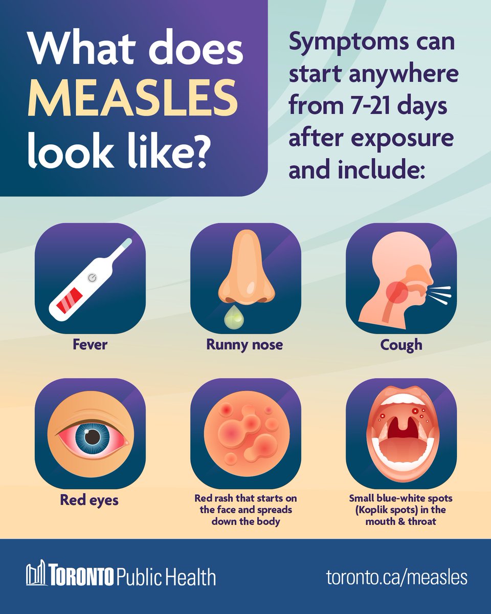 City of Toronto 🇨🇦 (@cityoftoronto) on Twitter photo Measles continues to spread in Toronto. <a href="/TOPublicHealth/">Toronto Public Health</a> reminds everyone to:
➡️ Check vaccine records. You are considered protected from measles if you got 2 doses of the vaccine.
➡️ Know the symptoms.
➡️ Learn what to do if you were exposed or get sick.
toronto.ca/Measles Measles continues to spread in Toronto. <a href="/TOPublicHealth/">Toronto Public Health</a> reminds everyone to:
➡️ Check vaccine records. You are considered protected from measles if you got 2 doses of the vaccine.
➡️ Know the symptoms.
➡️ Learn what to do if you were exposed or get sick.
toronto.ca/Measles