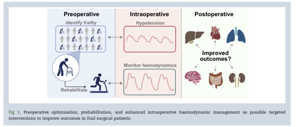 Ashish K. Khanna, MD,MS,FCCP,FCCM,FASA (@khannaashishccm) on Twitter photo Frailty and intraoperative hypotension connect? Can we modify the risk? <a href="/ASALifeline/">ASA®</a> <a href="/BJAJournals/">British Journal of Anaesthesia</a> pdf.sciencedirectassets.com/318044/AIP/1-s⦠<a href="/WakeAnesthesia/">Wake Forest Anesthesiology</a> <a href="/PittAnes/">Pitt Anesthesiology & Perioperative Medicine</a> <a href="/ClevelandClinic/">Cleveland Clinic</a> <a href="/HughHemmings/">Hugh Hemmings</a> Frailty and intraoperative hypotension connect? Can we modify the risk? <a href="/ASALifeline/">ASA®</a> <a href="/BJAJournals/">British Journal of Anaesthesia</a> pdf.sciencedirectassets.com/318044/AIP/1-s⦠<a href="/WakeAnesthesia/">Wake Forest Anesthesiology</a> <a href="/PittAnes/">Pitt Anesthesiology & Perioperative Medicine</a> <a href="/ClevelandClinic/">Cleveland Clinic</a> <a href="/HughHemmings/">Hugh Hemmings</a>